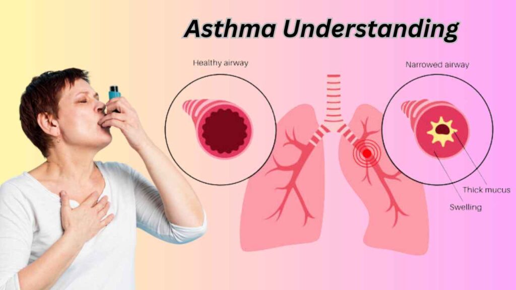 Understanding Asthma: Breathe Easy