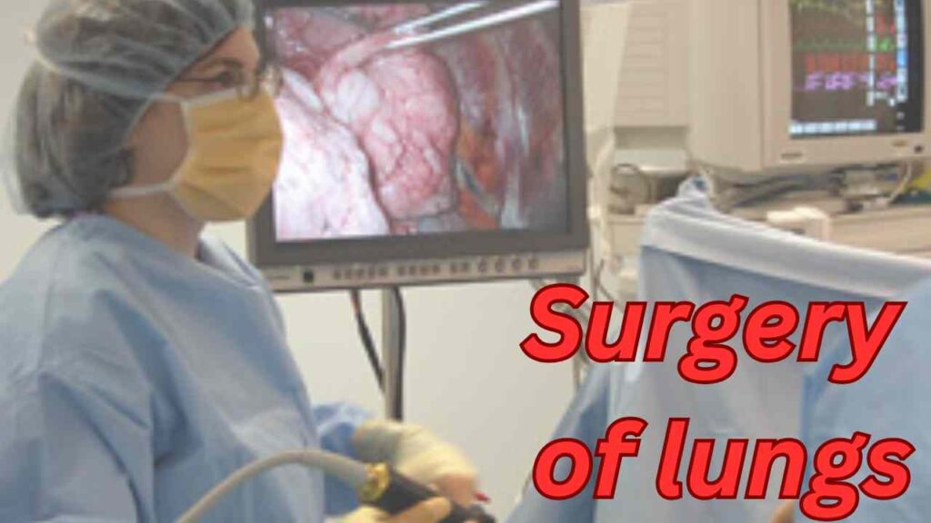 Surgery of lungs